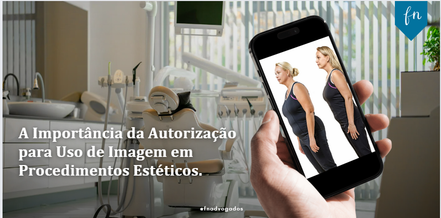 A Importância da Autorização para Uso de Imagem em Procedimentos Estéticos